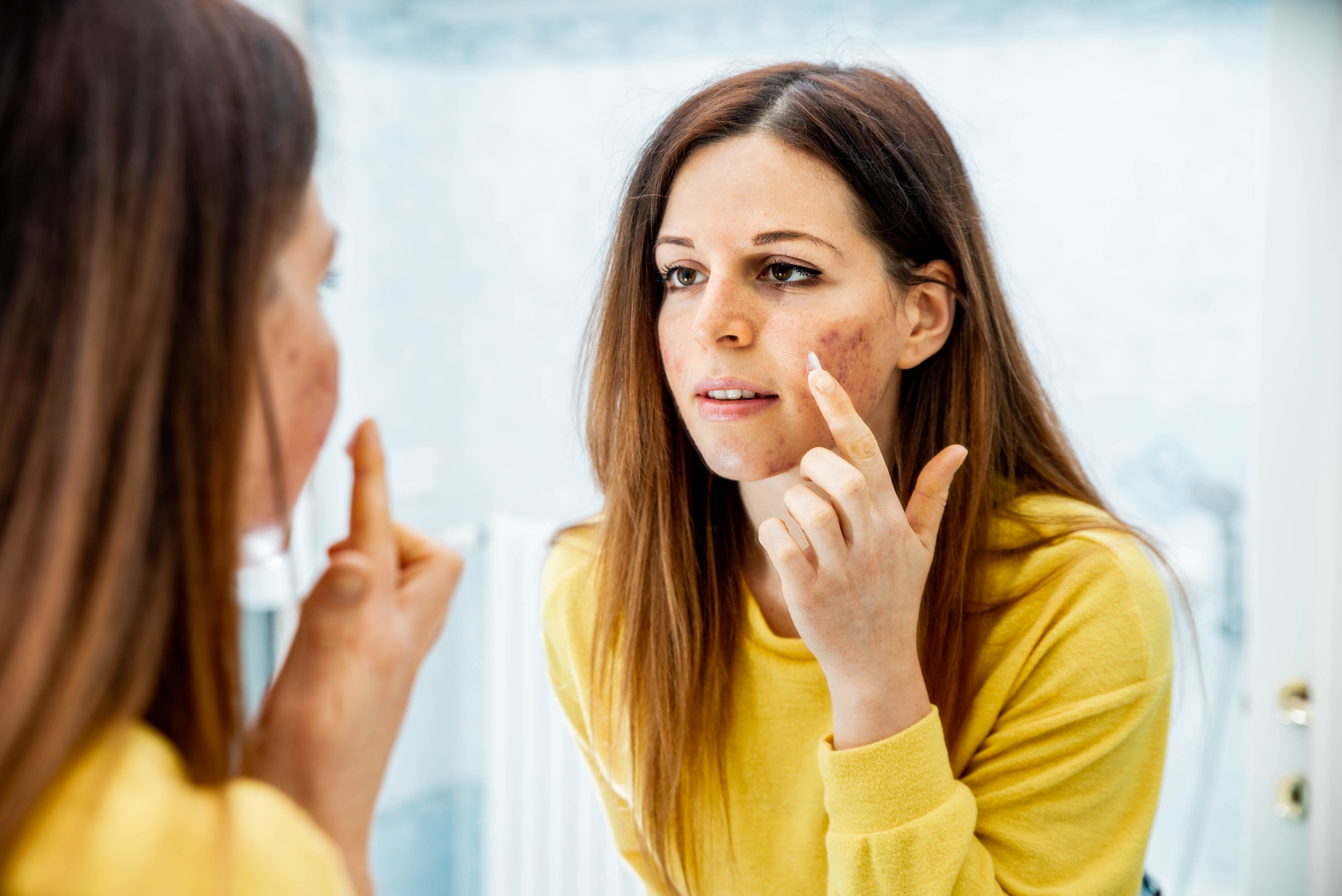 Top Produtos The Ordinary para Pele Oleosa e com Acne